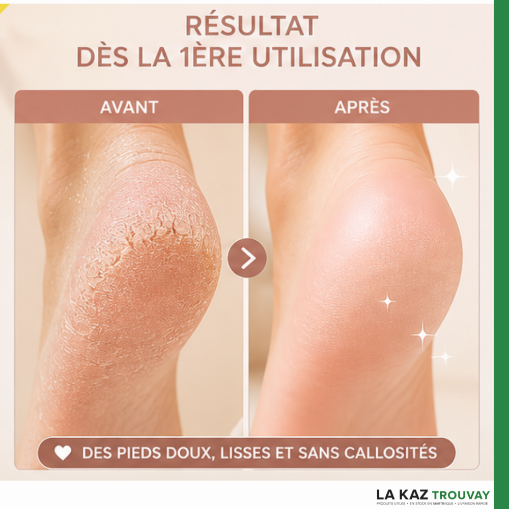 Ponceuse Pied Portable Pro™ – Pieds Doux & Lisses Dès La 1ère Utilisation